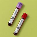 Essentielle B-Vitamine Bluttest