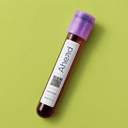 Lipoprotein (a) Bluttest