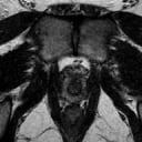 Gender health (prostate or ovaries)